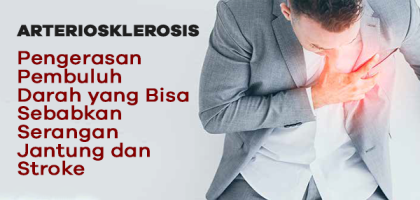 ARTERIOSKLEROSIS? Pengerasan Pembuluh Darah yang Bisa Sebabkan Serangan Jantung dan Stroke